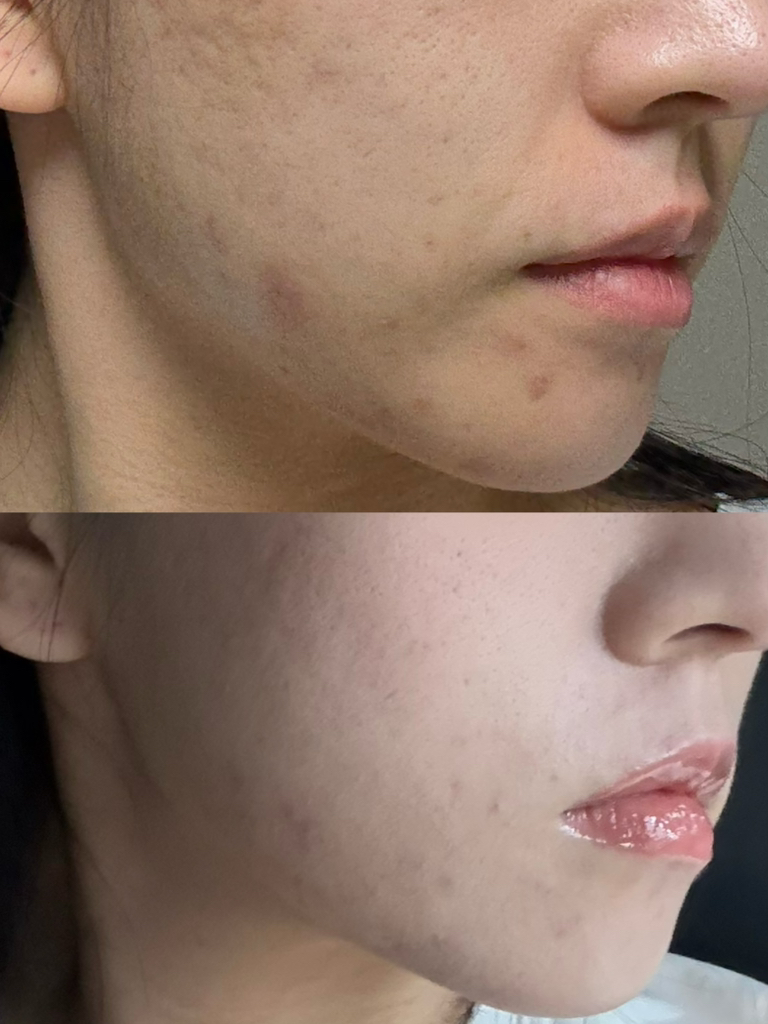 피몽쉐 (Phymongshe) 아쿠아 블레미쉬 커버 밤 review image