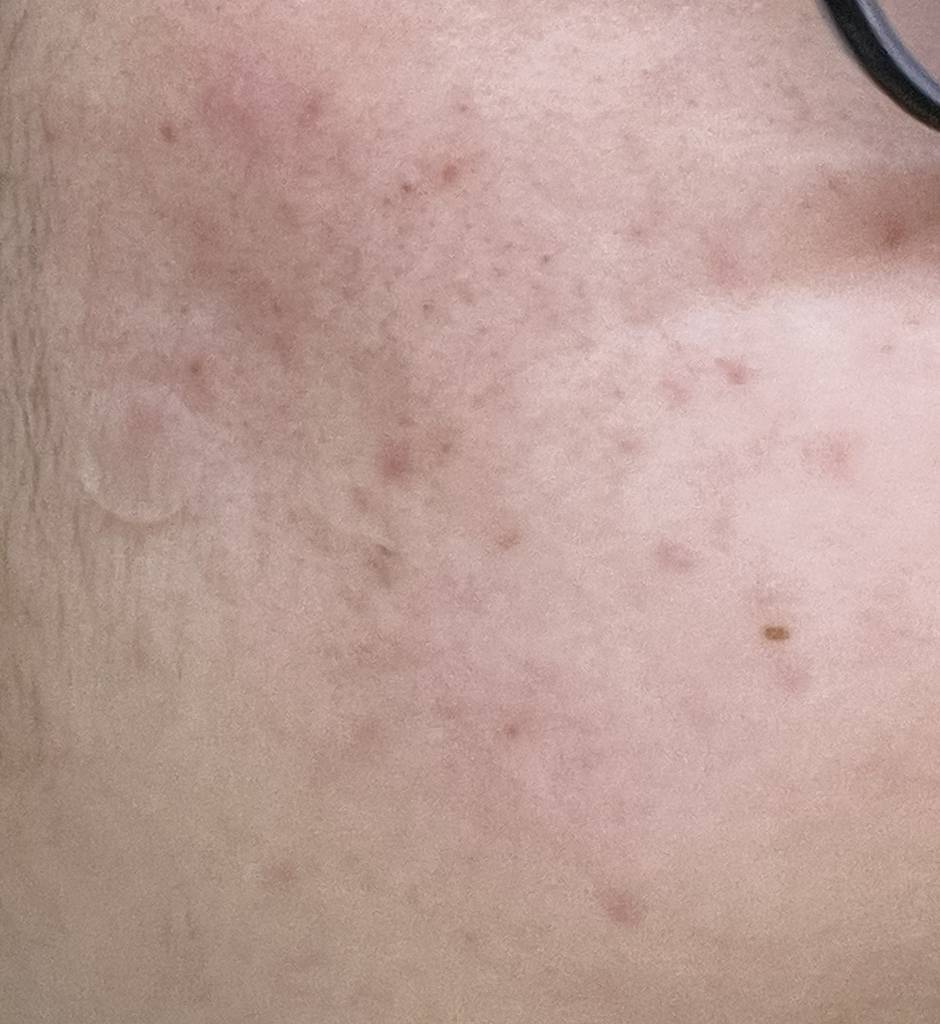 에이솔루션 (asolution) 어성초 트러블 토너 review image