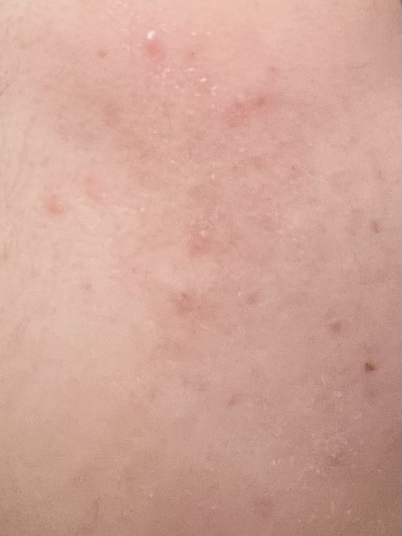 에이솔루션 (asolution) 어성초 트러블 토너 review image