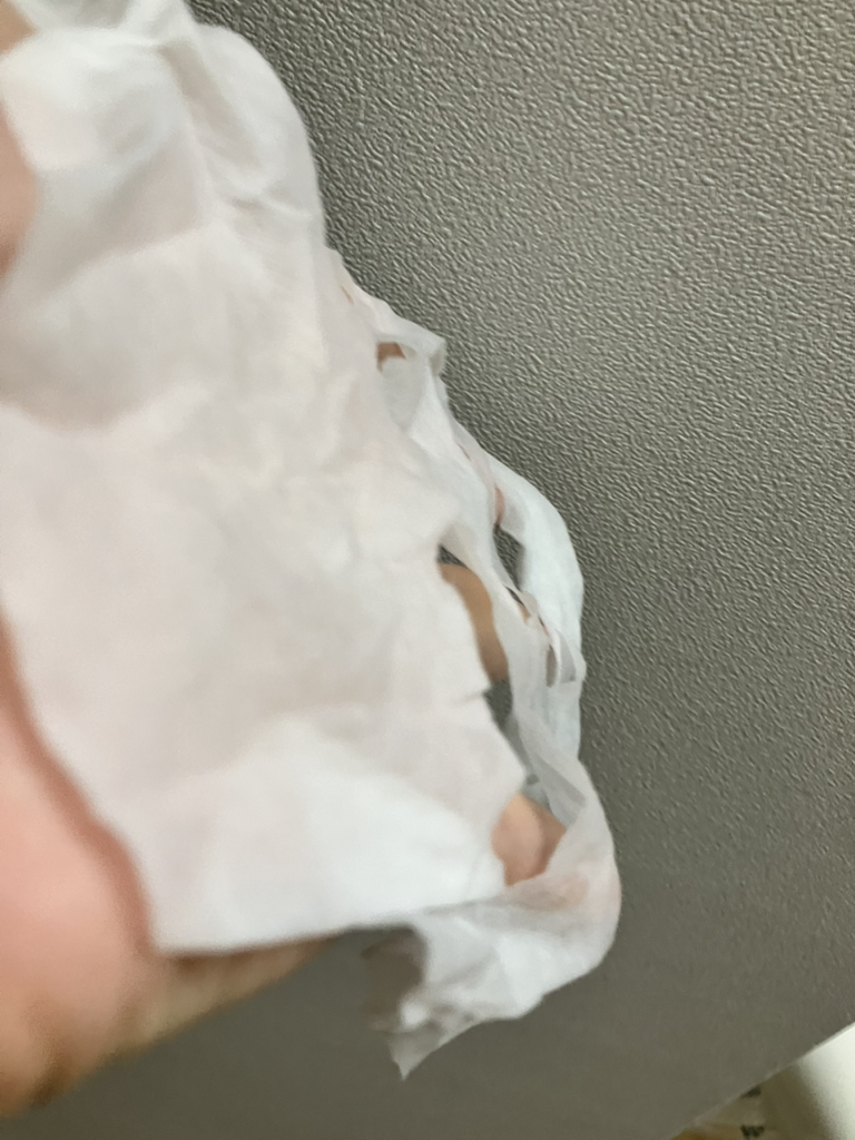 鱼腥草面膜的真实用户使用照片