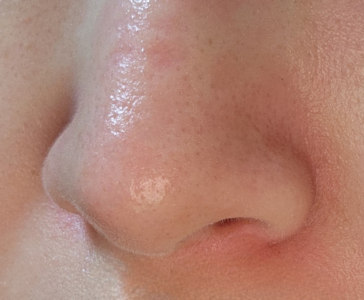 메디힐 (MEDIHEAL) 블랙헤드 멜팅 클리어 코팩 review image