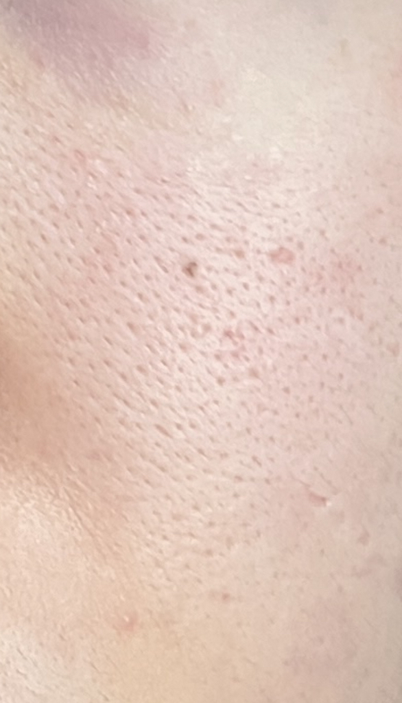 마미케어 (mommycare) 바다포도 모공앰플 review image