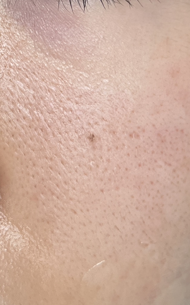 마미케어 (mommycare) 바다포도 모공앰플 review image