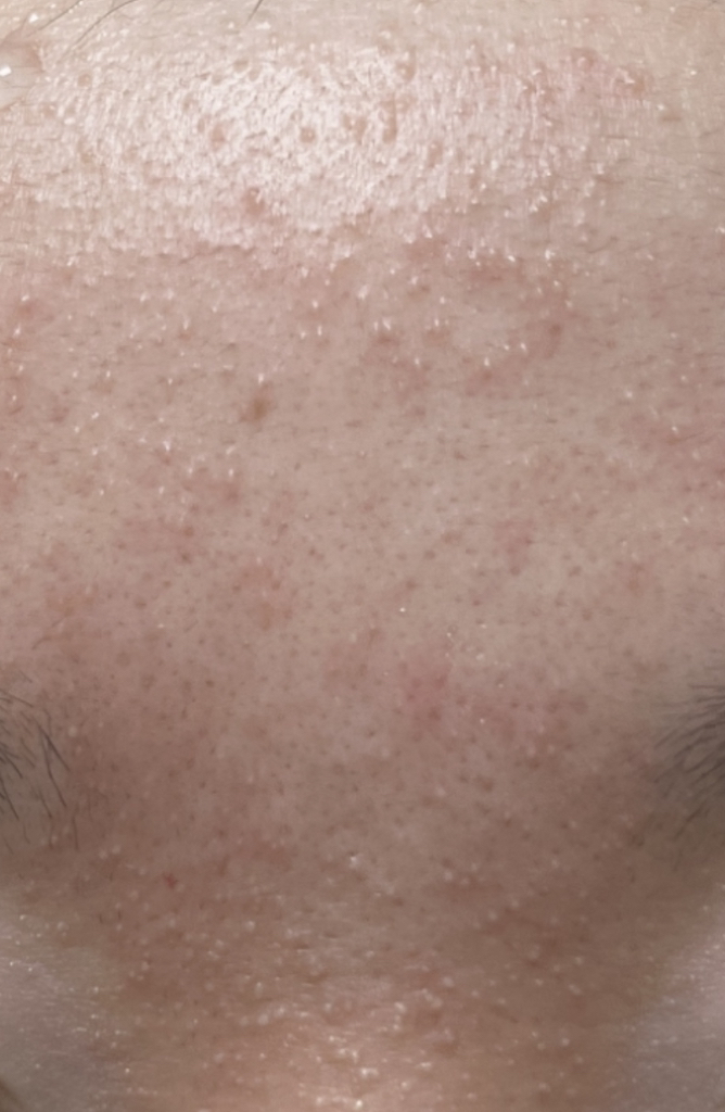 마미케어 (mommycare) 한방 생율무크림 review image