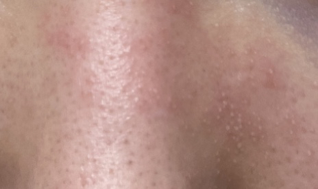 마미케어 (mommycare) 한방 생율무크림 review image