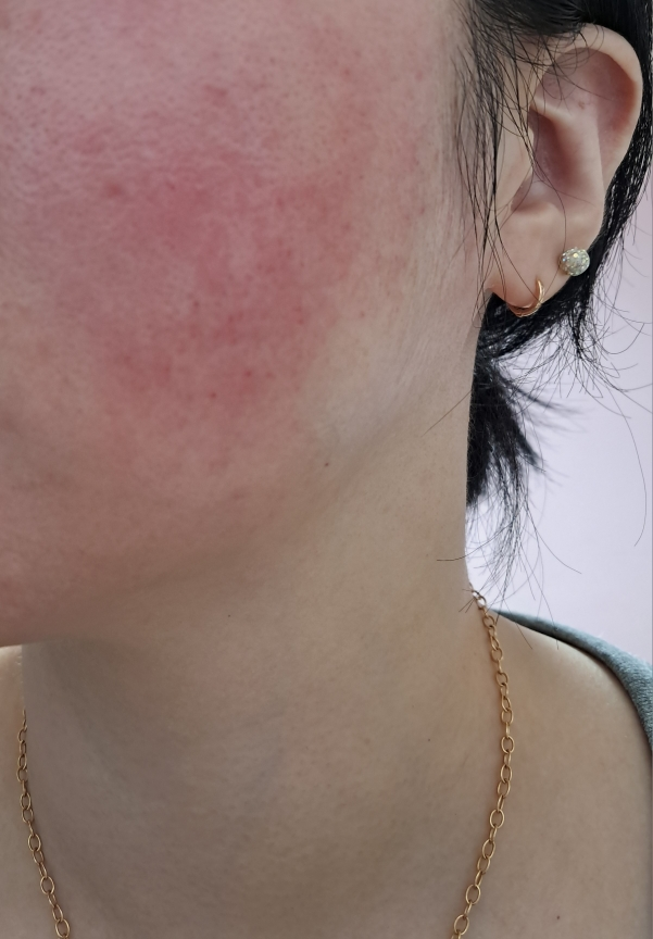 Ảnh đánh giá thực tế của người dùng về Galactomyces Niacin Fermented Essence