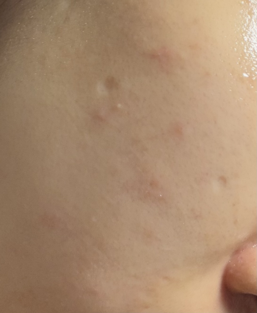 积雪草淄醇爽肤水的真实用户使用照片