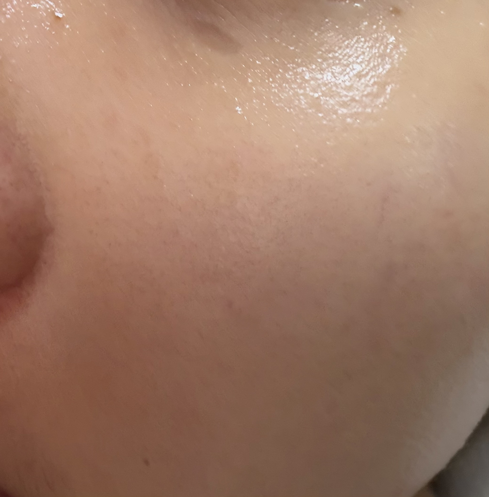 积雪草淄醇爽肤水的真实用户使用照片