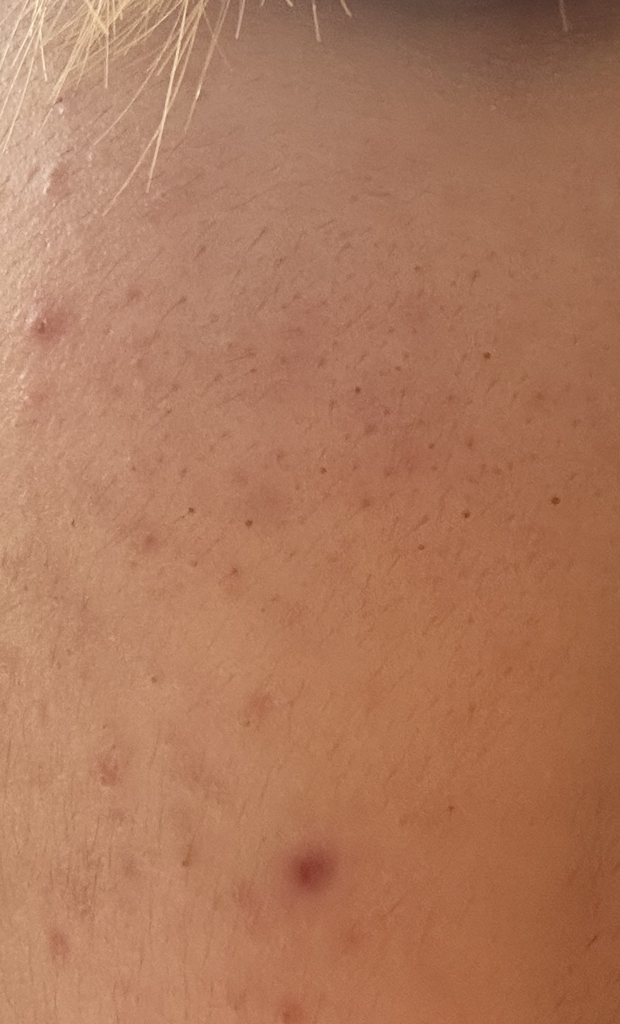 빌리프 (belif) 프라블럼 솔루션 비건 PHA 클리어링 토너 review image