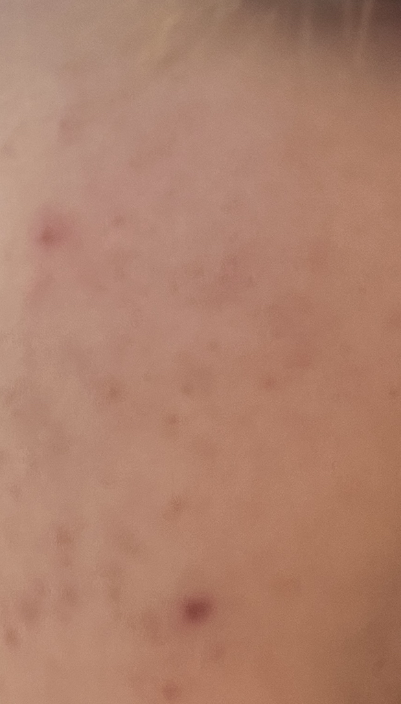 빌리프 (belif) 프라블럼 솔루션 비건 PHA 클리어링 토너 review image