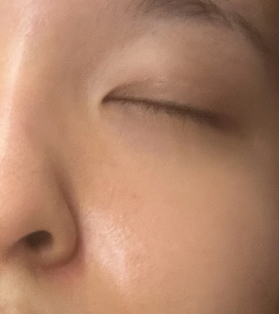 Atoderm Ultra 霜的真实用户使用照片