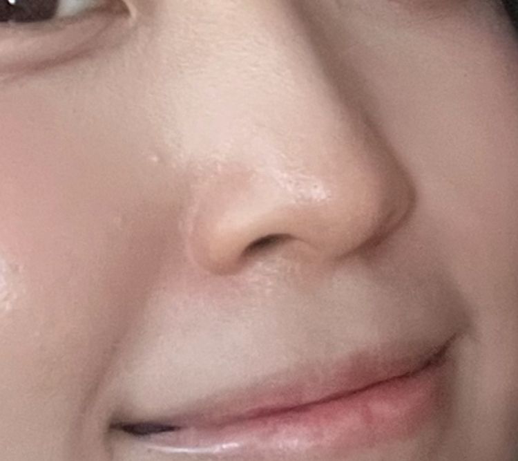 Atoderm Ultra 霜的真实用户使用照片