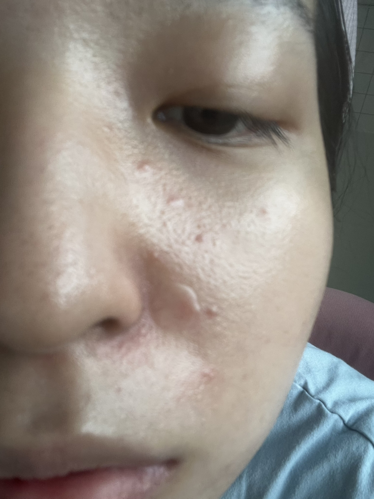 Atoderm Ultra 霜的真实用户使用照片