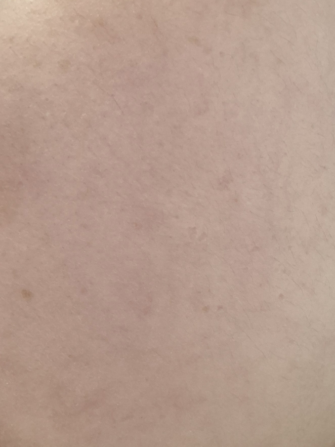 理肤泉 Epacla Duo(+) 精华素 common.review image