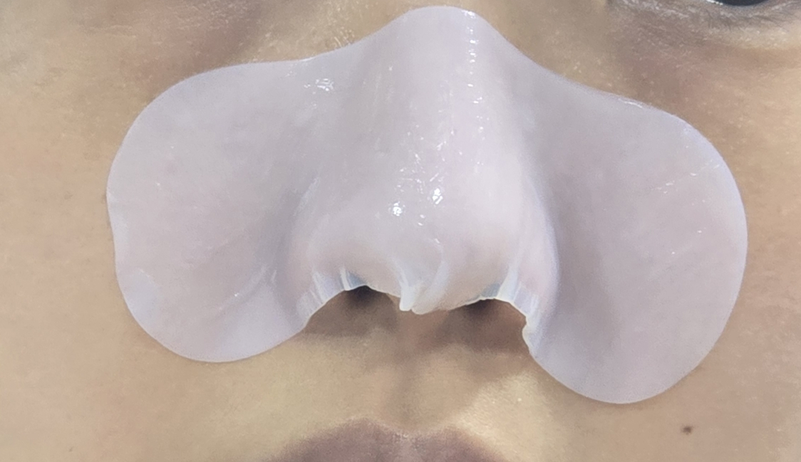 柔恩莱 松树舒缓 Shikakopak common.review image