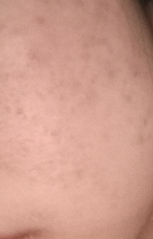 白桦水分面膜的真实用户使用照片