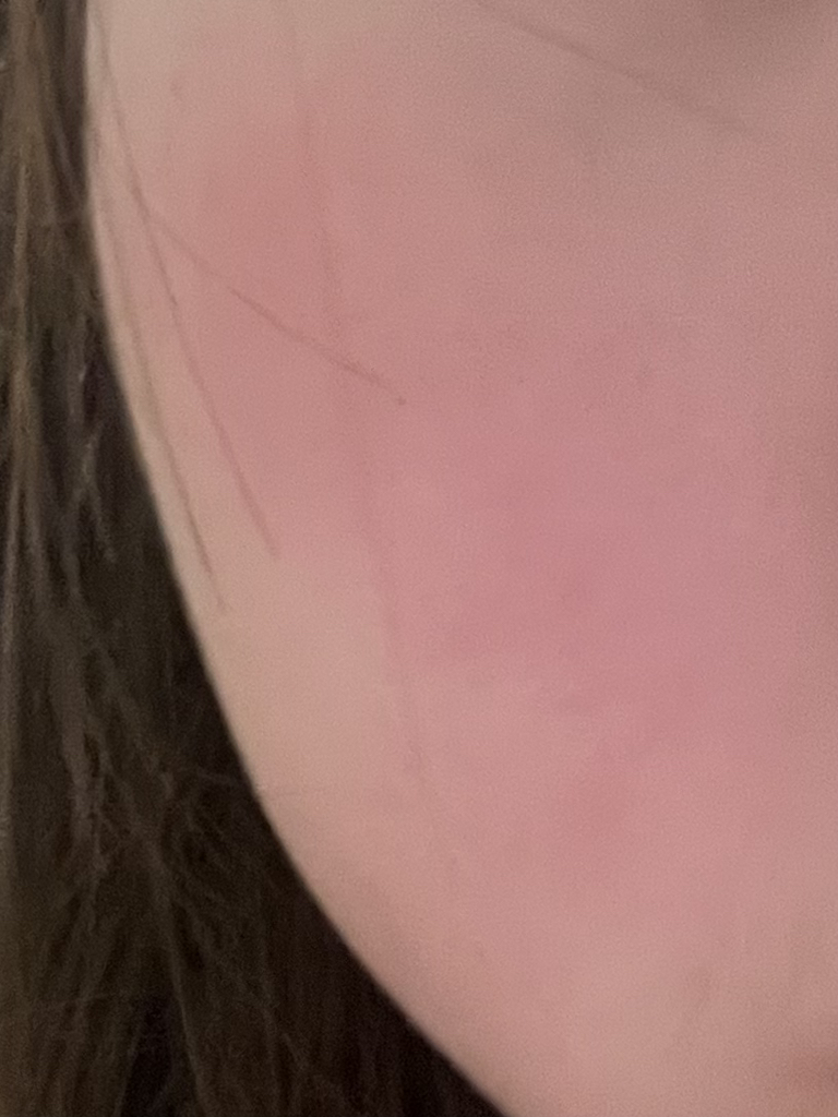 鱼迹精华垫透明触感的真实用户使用照片