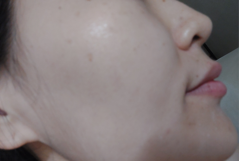 YBK (와이비케이) 세라마이드 릴리프 하이드레이션 에멀젼 review image