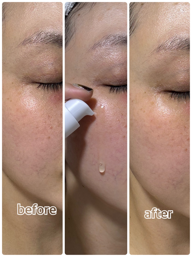 믹순 (mixsoon) 콩 에센스 review image