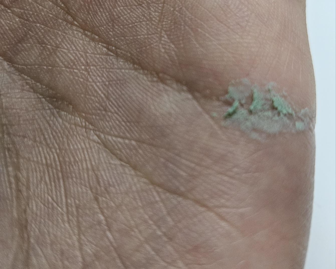 보나메두사 (bonamedusa) 오렌지 스킨 딜리트 소프트그린 review image
