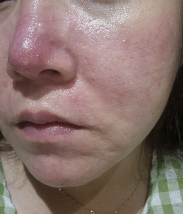 铷 护理修护 Shikagel 面膜 common.review image