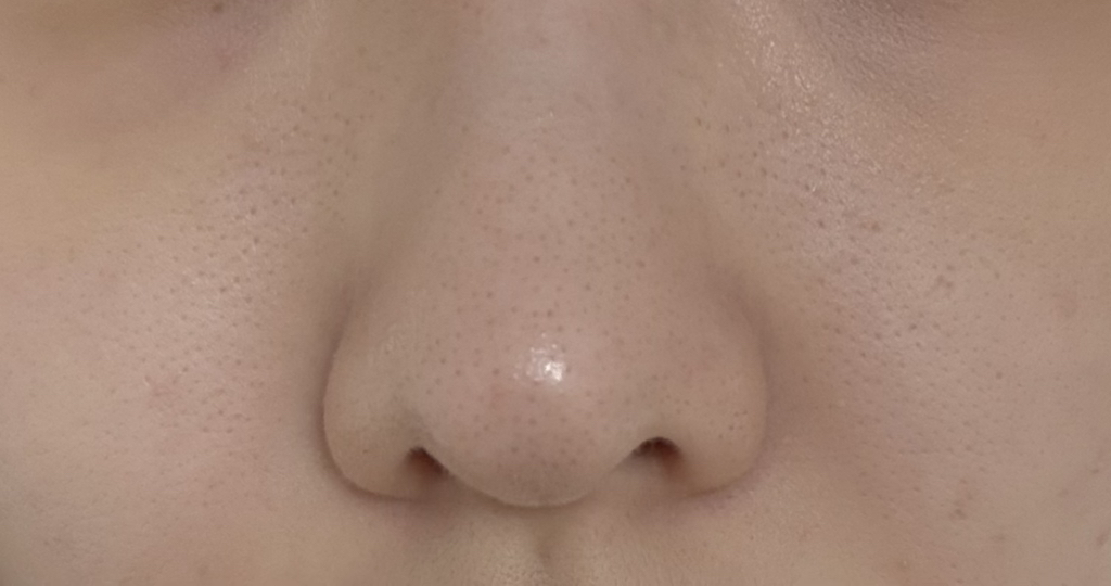 보나메두사 (bonamedusa) 오렌지 스킨 딜리트 소프트그린 review image