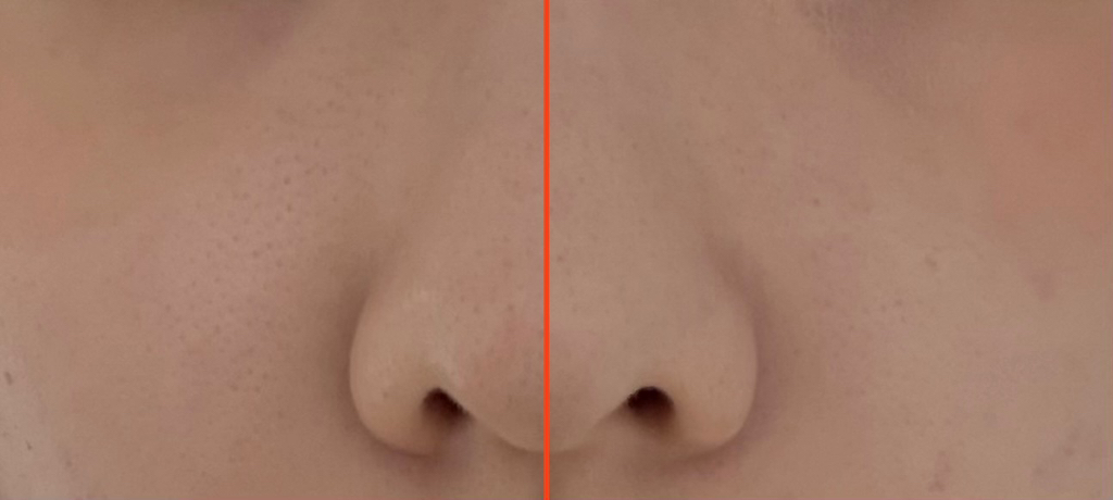 보나메두사 (bonamedusa) 오렌지 스킨 딜리트 소프트그린 review image