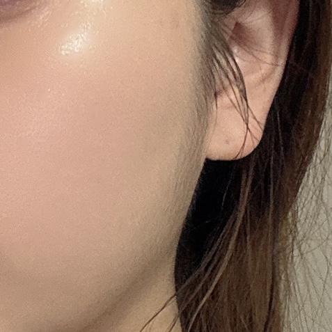 닥터오라클 (Dr.Oracle) 나이아브라이트™ 기미 스팟 크림 review image