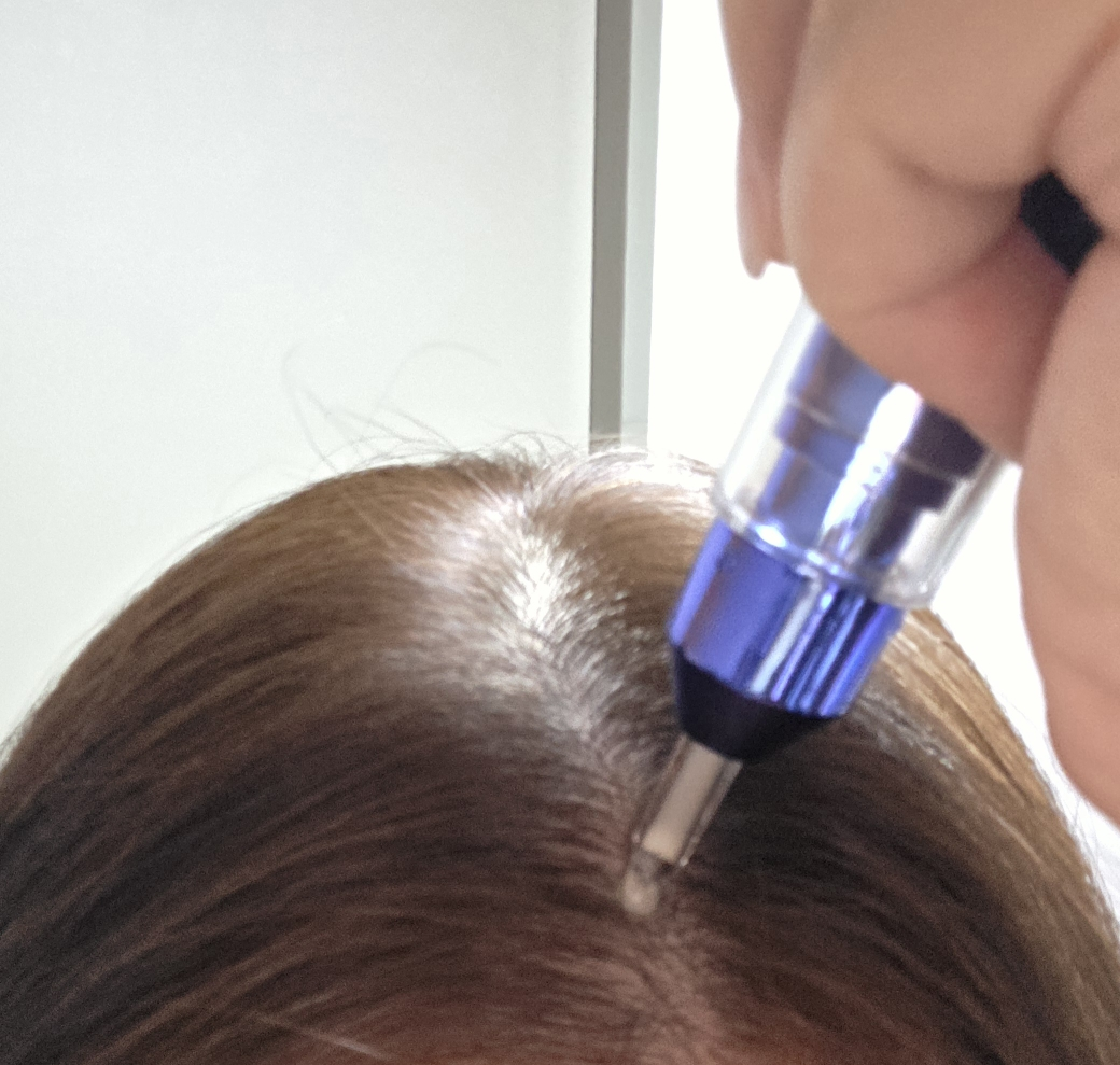 바이브랩 (ViveLab) 스피옥실 리액트샷 400 탈모앰플 review image