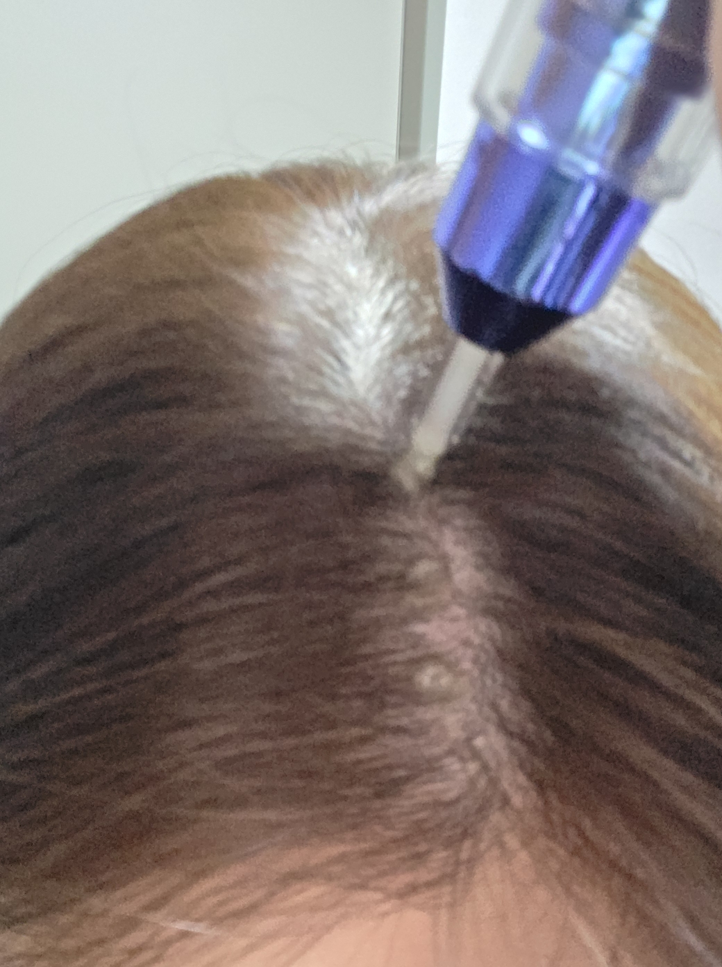 바이브랩 (ViveLab) 스피옥실 리액트샷 400 탈모앰플 review image