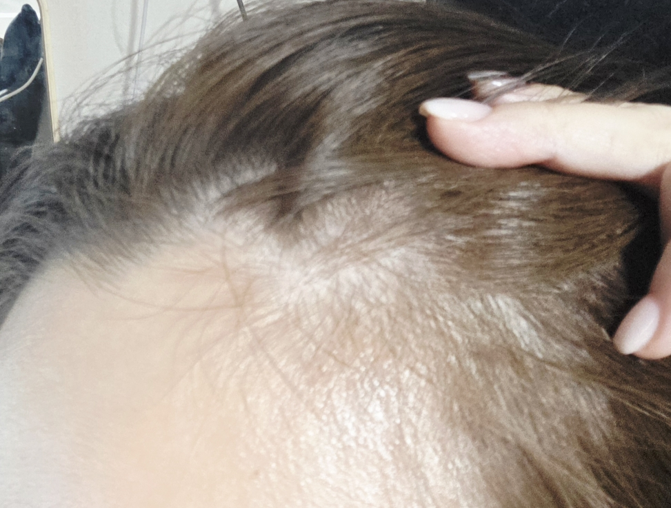 바이브랩 (ViveLab) 스피옥실 리액트샷 400 탈모앰플 review image