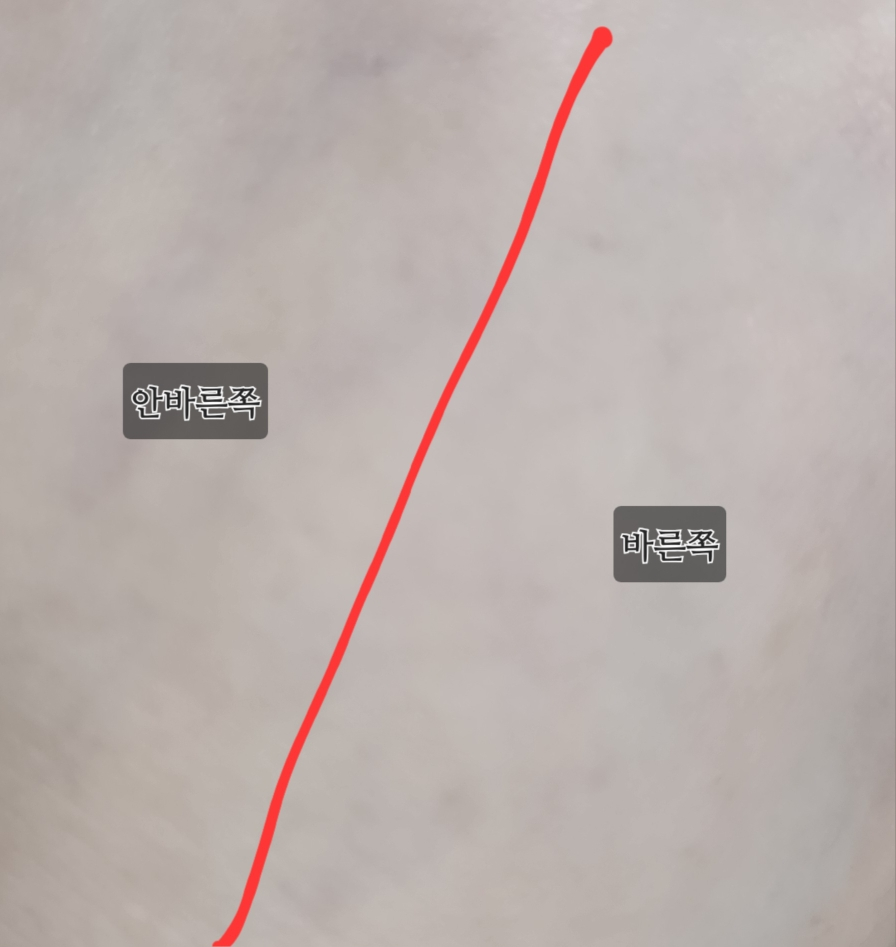 보나메두사 (bonamedusa) 오렌지 스킨 딜리트 소프트그린 review image