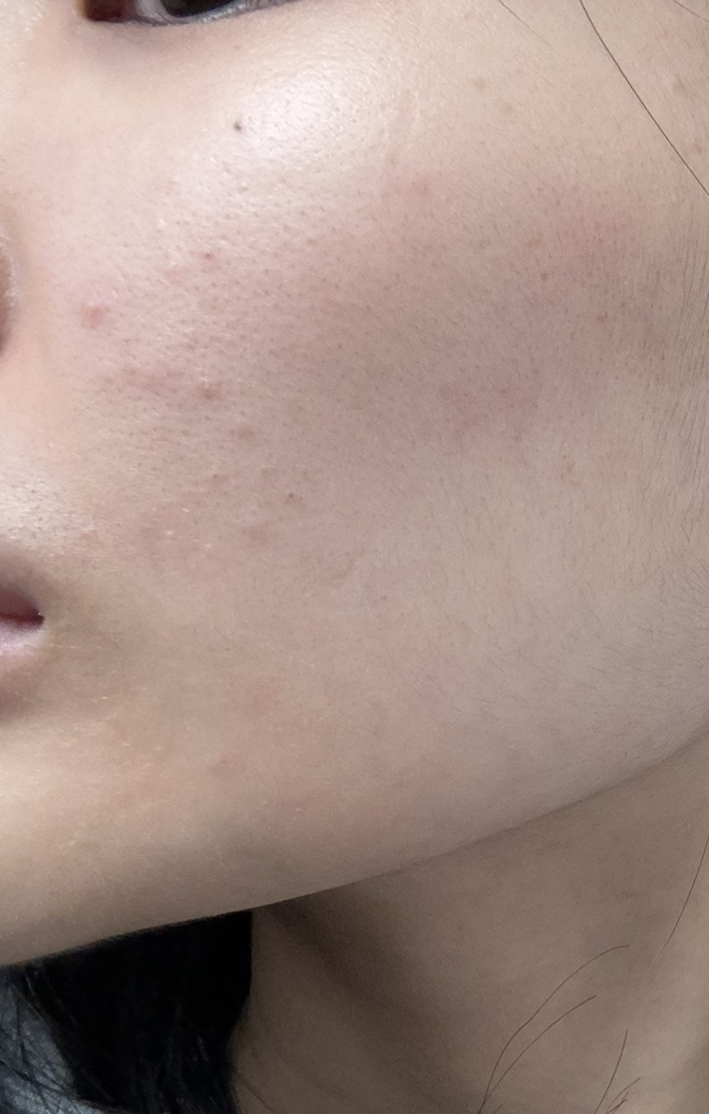 ToneStain 色彩校正底霜 [SPF20/PA++] [03 Serenity] [03 Serenity的真实用户使用照片