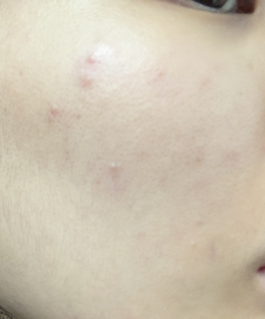 ToneStain 色彩校正底霜 [SPF20/PA++] [03 Serenity] [03 Serenity的真实用户使用照片