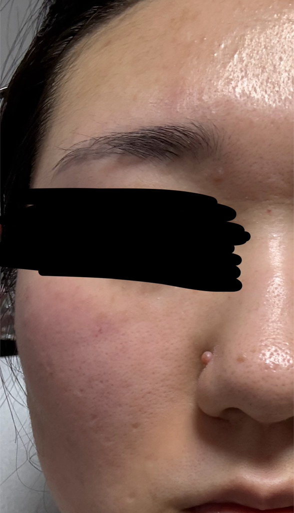 셀누트 (CellNutt) 마이세컨스킨 CICA+글루타치온 review image