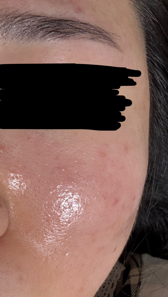 셀누트 (CellNutt) 마이세컨스킨 CICA+글루타치온 review image