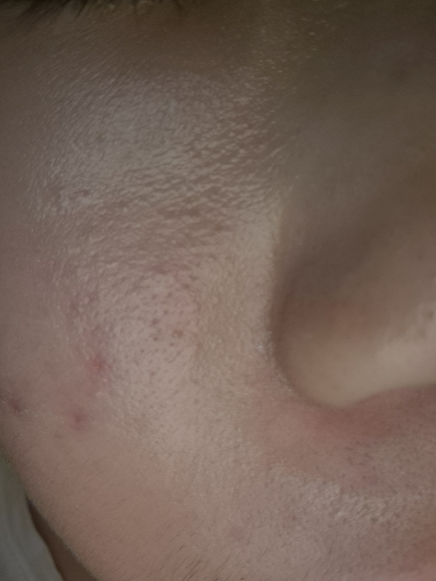 마미케어 (mommycare) 바다포도 모공앰플 review image