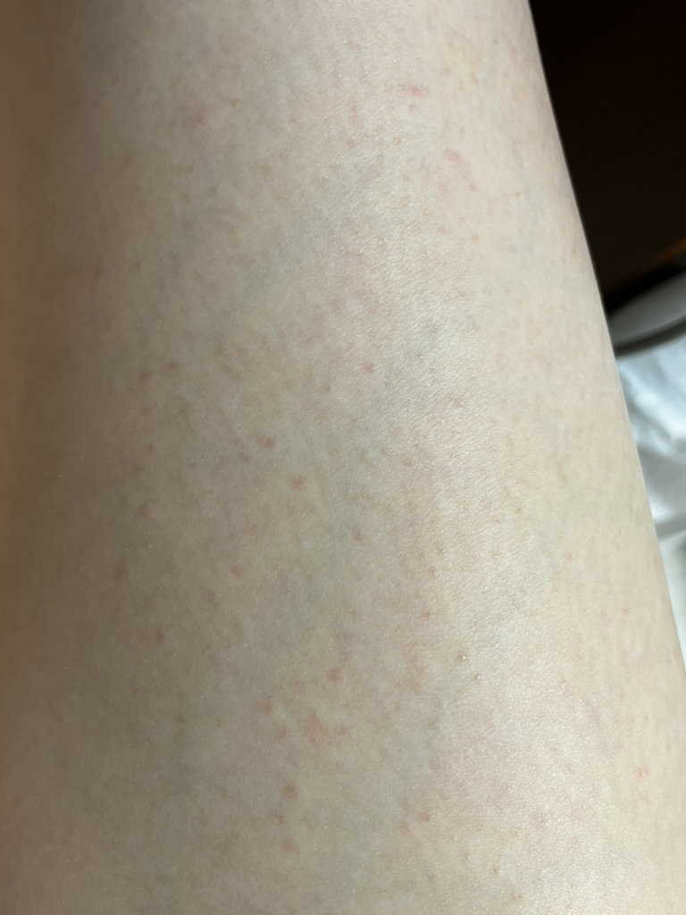 일리윤 (ILLIYOON) 울트라 리페어 로션 review image