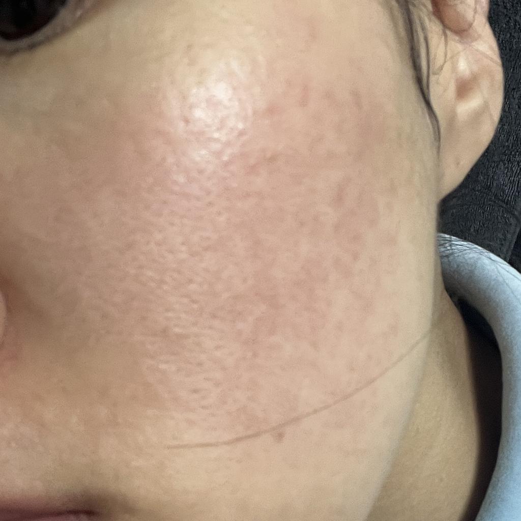 셀리맥스 (celimax) 시카 지우개패드 review image