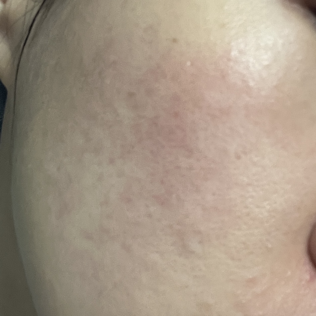 셀리맥스 (celimax) 시카 지우개패드 review image