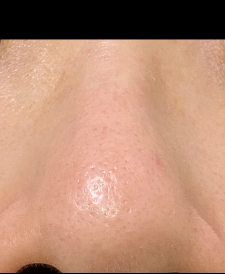 Ảnh đánh giá thực tế của người dùng về Pigisoksoks No More Blackhead Cleaner