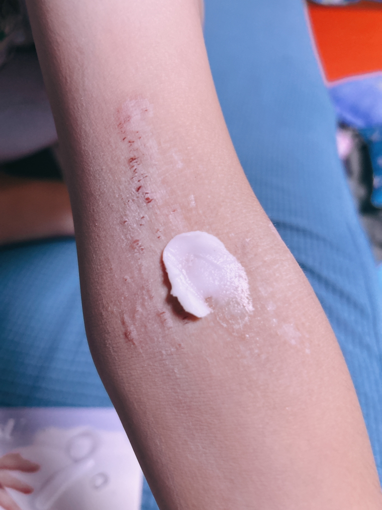 阿托吉塞拉皮肤屏障霜的真实用户使用照片