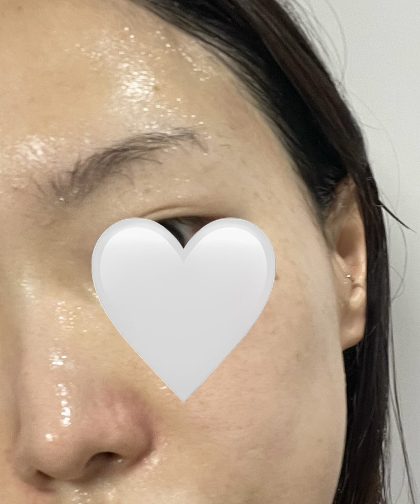 Derma Cream Pack 洁面乳 马德卡索苷 [镇静屏障］的真实用户使用照片