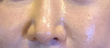 랩노 (LabNo) 리프티드 이데베논 세럼 review image