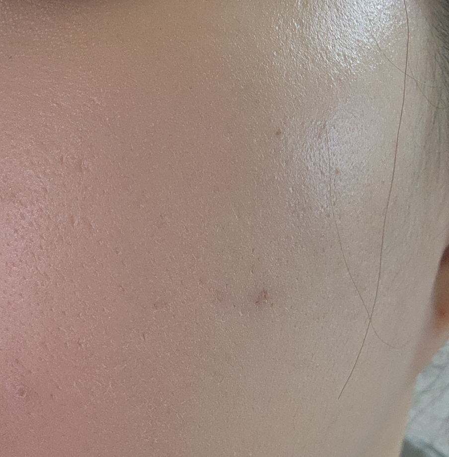 黑樱桃收缩毛孔霜 Lofd的真实用户使用照片