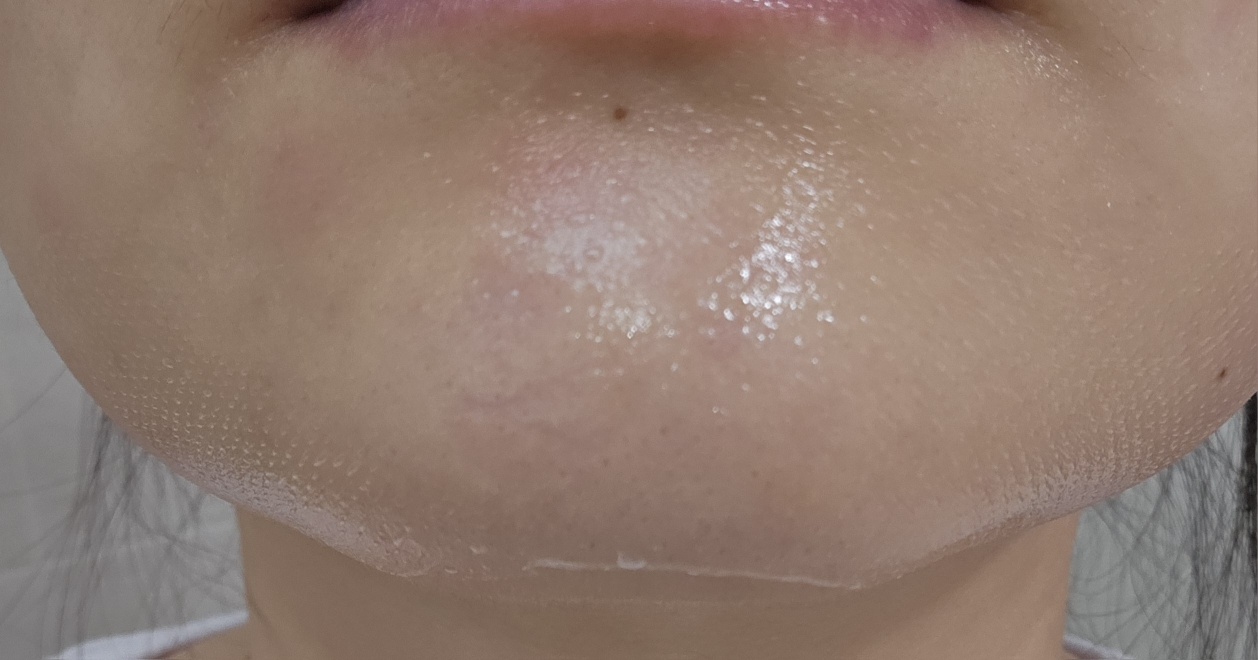 MySecondSkin CICA+谷胱甘肽的真实用户使用照片