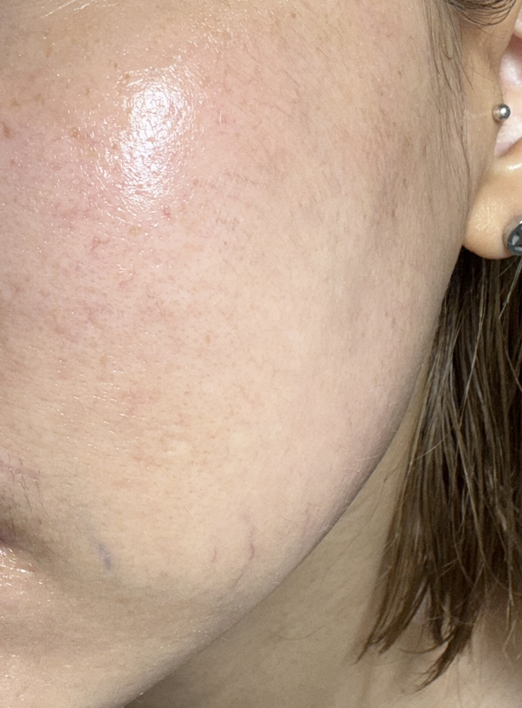 유이크 (UIQ) 바이옴 베리어 파하 결 앰플 review image