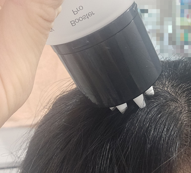 리필드 (Refilled) 사이토카인 부스터 [프로] review image