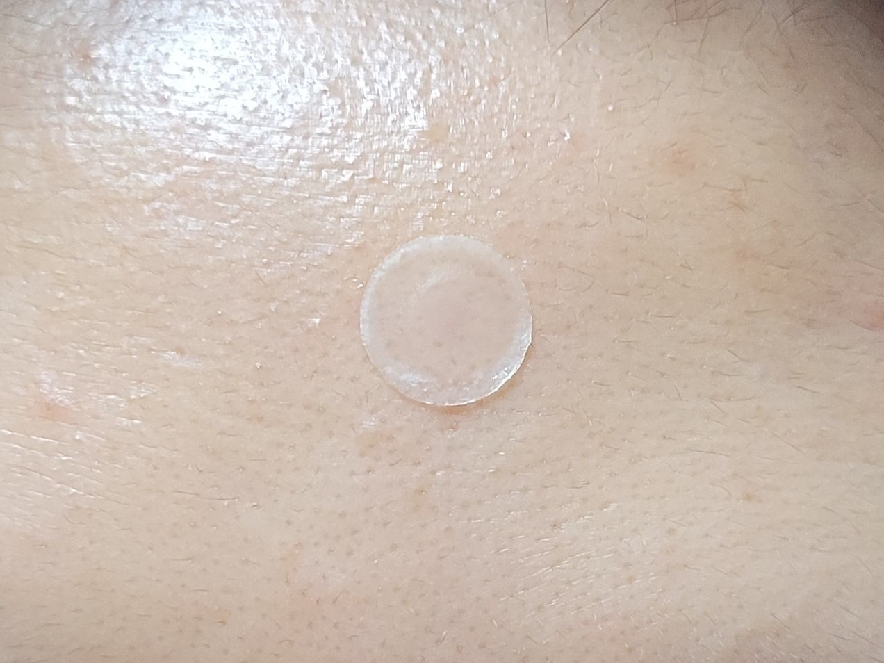 마녀공장 (manyo) 프록실 AC 레스큐 스팟 패치 review image