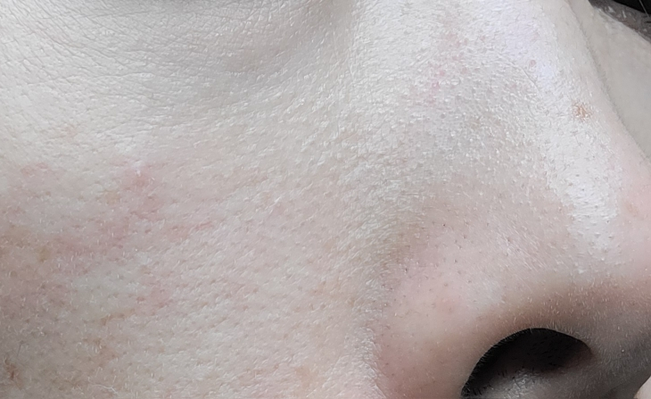 스트라이덱스 (STRIDEX) 맥스플러스패드 review image